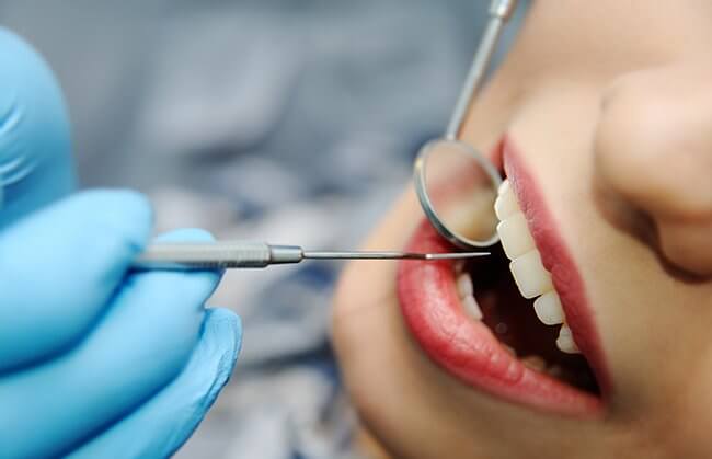 Parodontózis tünetei és kezelése